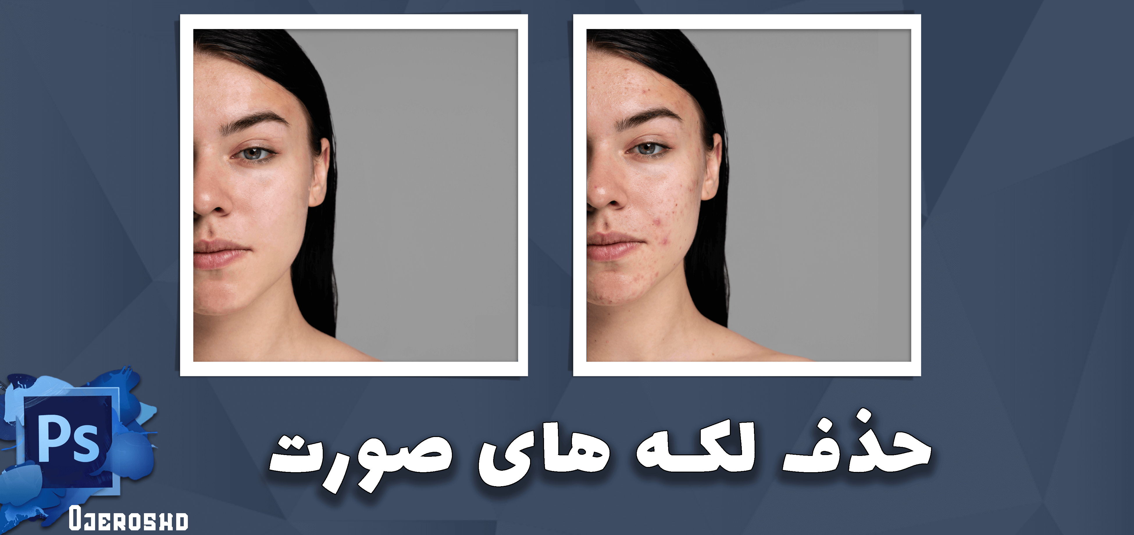 حذف لکه‌های صورت در فتوشاپ